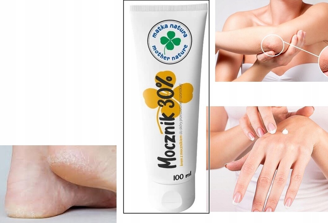 Na obrazie widoczna jest tubka kremu z napisem \'Mocznik 30%\' oraz logo \'matka natura\'. Obok znajdują się zdjęcia przedstawiające skórę łokcia, dłoni i pięty.