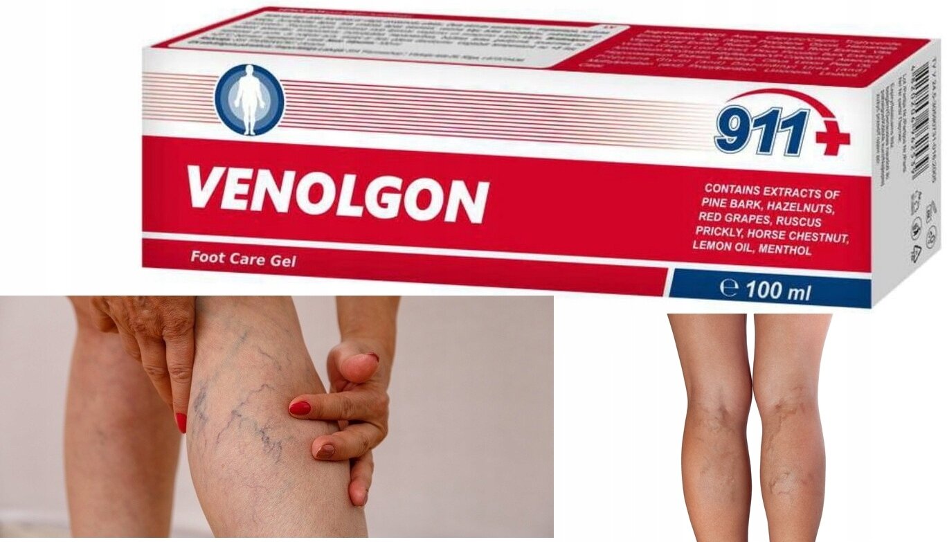 Opakowanie produktu Venolgon 911+ o pojemności 100 ml z widocznym logo i informacją o składnikach, takich jak kasztanowiec i mentol. Obok zdjęcie nóg z widocznymi żylakami, na które nakładana jest maść.