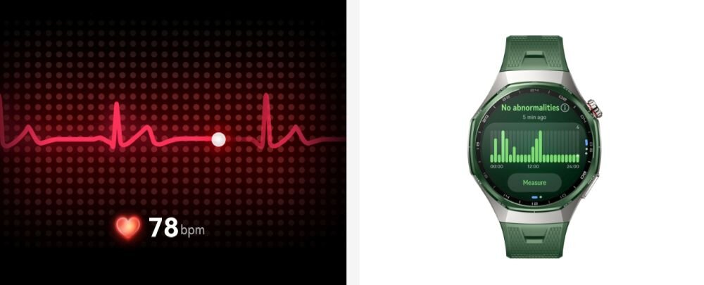 Po lewej stronie widoczny jest wykres EKG z czerwonym tłem i wartością 78 bpm. Po prawej stronie znajduje się zielony smartwatch z wyświetlaczem pokazującym wykres i tekst \'No abnormalities\'.