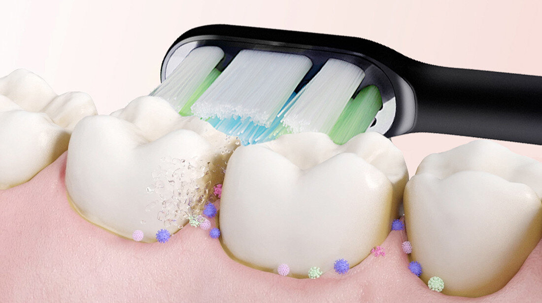 Końcówka szczoteczki SOOCAS X5/X3/X3U Różowy (2 sztuki) 3 wersje kolorystyczne