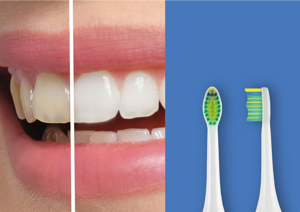 Szczoteczka soniczna EVOREI Sonic 2