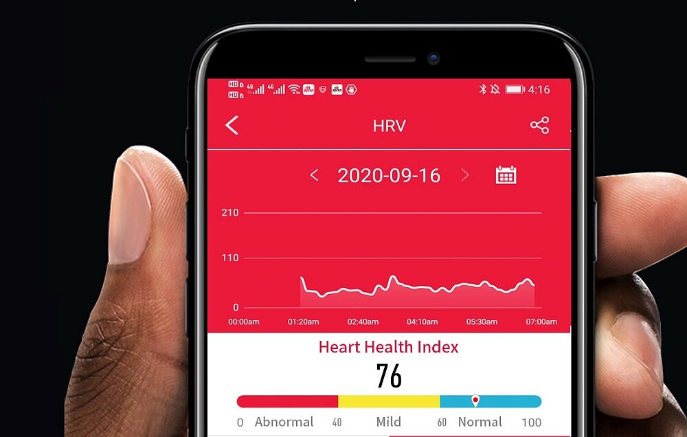 Smartwatch COLMI SKY7 Pro ekran sport zdrowie serce bateria pojemność ładowanie aplikacja powiadomienia sen 