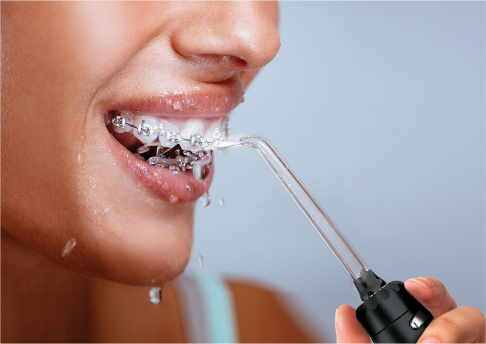 Irygator EVOREI Boost 2