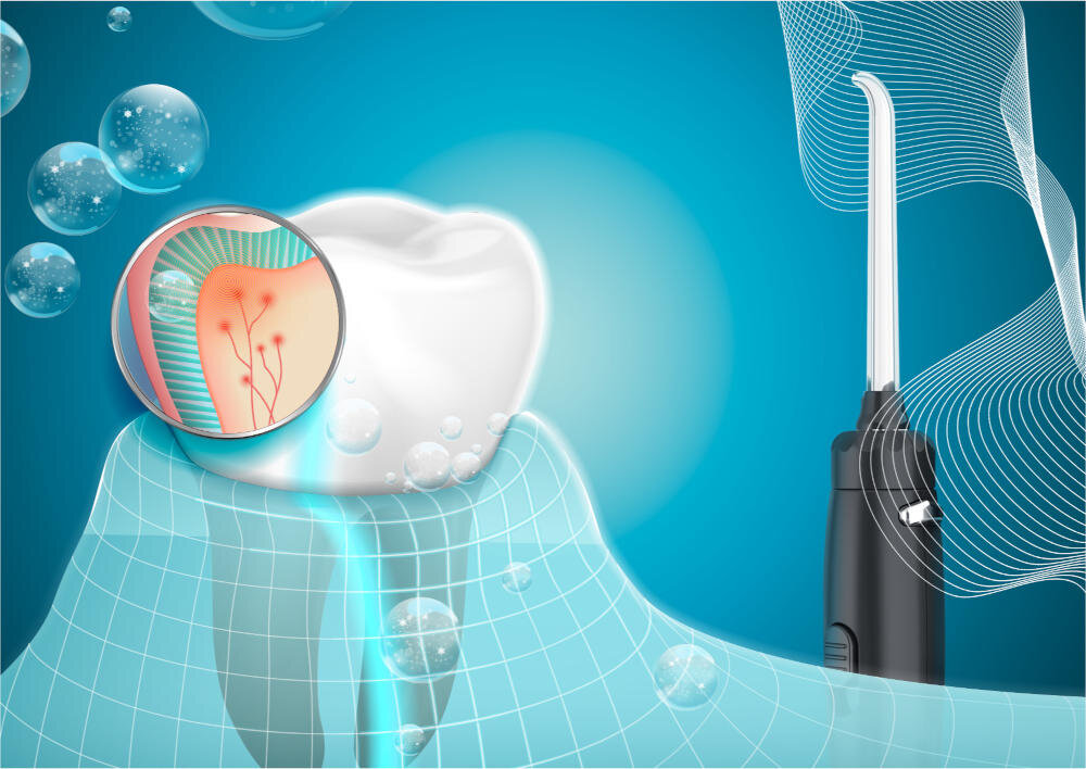 Irygator EVOREI Boost 2