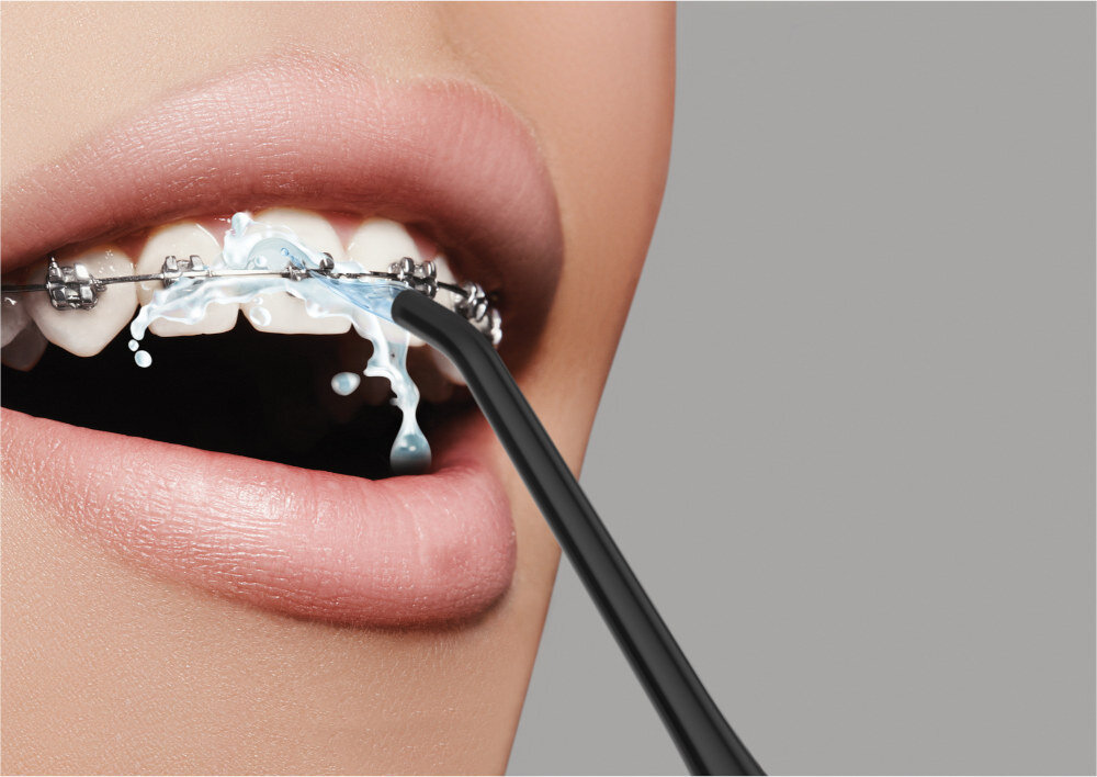 Irygator EVOREI Boost 1