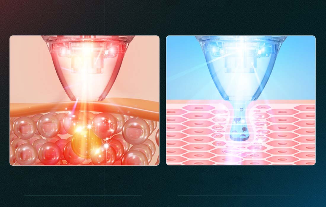 Urządzenie do pielęgnacji twarzy ANLAN 01-AHTY11-06A fale oczyszczanie skóry