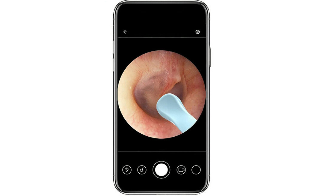 Oczyszczacz do uszu XIAOMI Mi Bebird Smart Ear Pick R3 Biala kamera z soczewka