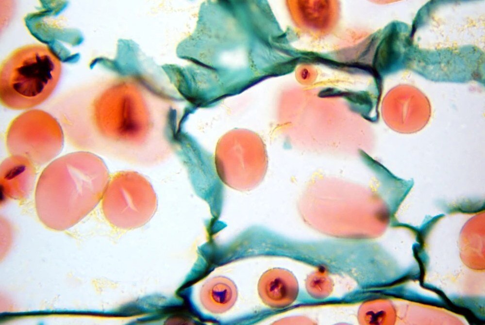 Mikroskop DELTA OPTICAL Genetic Trino obiektywy