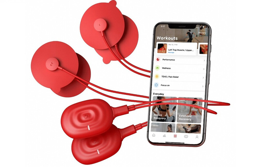 FRANKE Centro CNG 611-62 114.0633.088 zlewozmywak fragranite wytrzymałość zarysowania