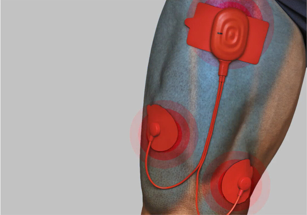 FRANKE Centro CNG 611-62 114.0633.088 zlewozmywak fragranite trwałość niezawodność solidny odporność zarysowania uszkodzenia promieniowanie zmiany temperatura