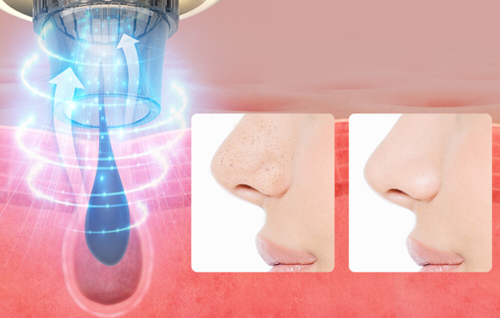 Odkurzacz do wągrów i zaskórników ANLAN 01-AHTY12-03A zdrowa skóra jędrność