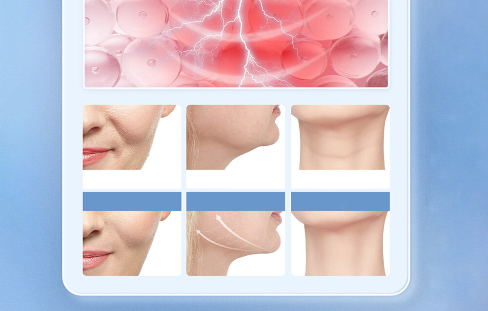 Urządzenie do peelingu kawitacyjnego ANLAN 01-ACPJ13-02A wygląd ogólny cechy szczególne