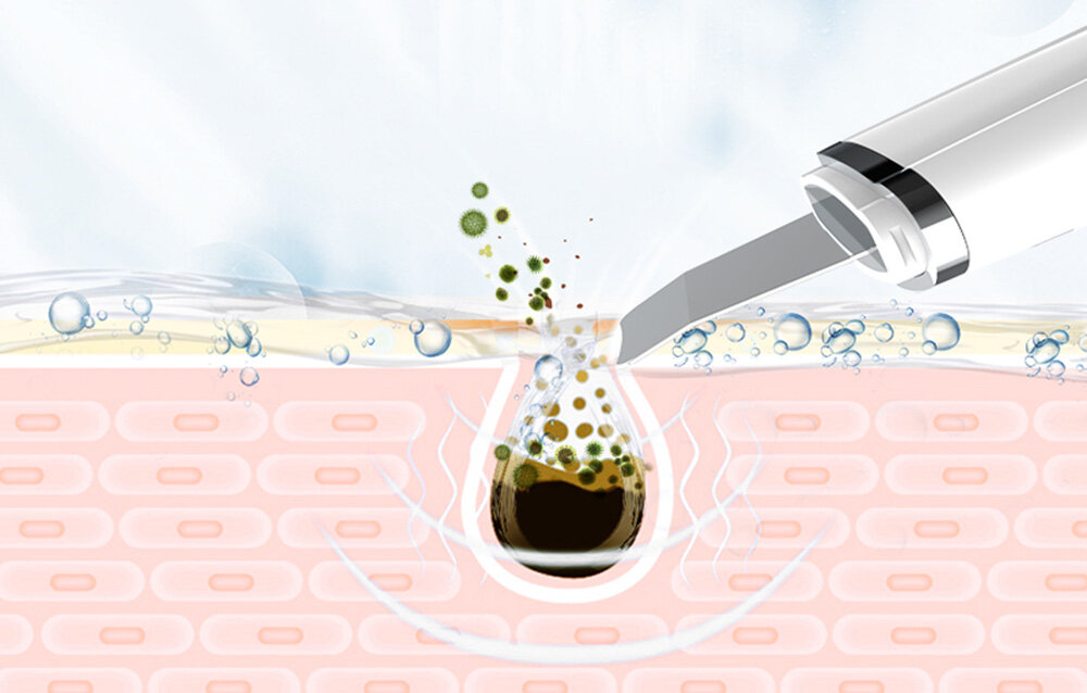 Urządzenie do peelingu kawitacyjnego ANLAN ALCPJ09-02 częstotliwości skuteczność