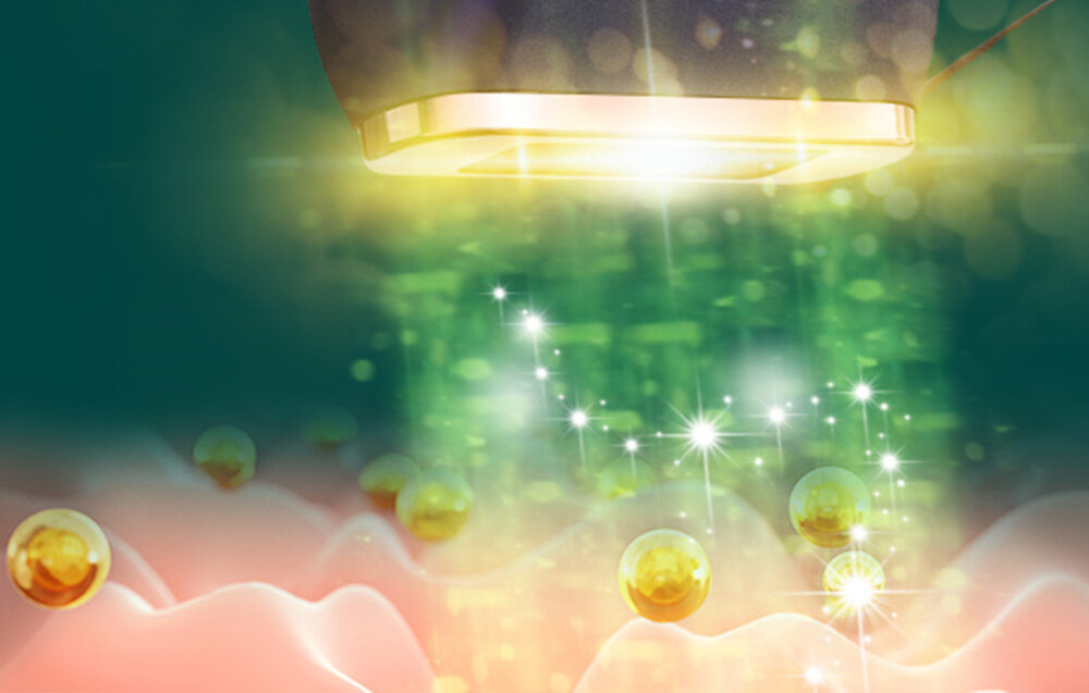 Depilator KENSEN Hammer IPL MZ-IPL01 Technologia IPL 500 000 impulsow swietlnych