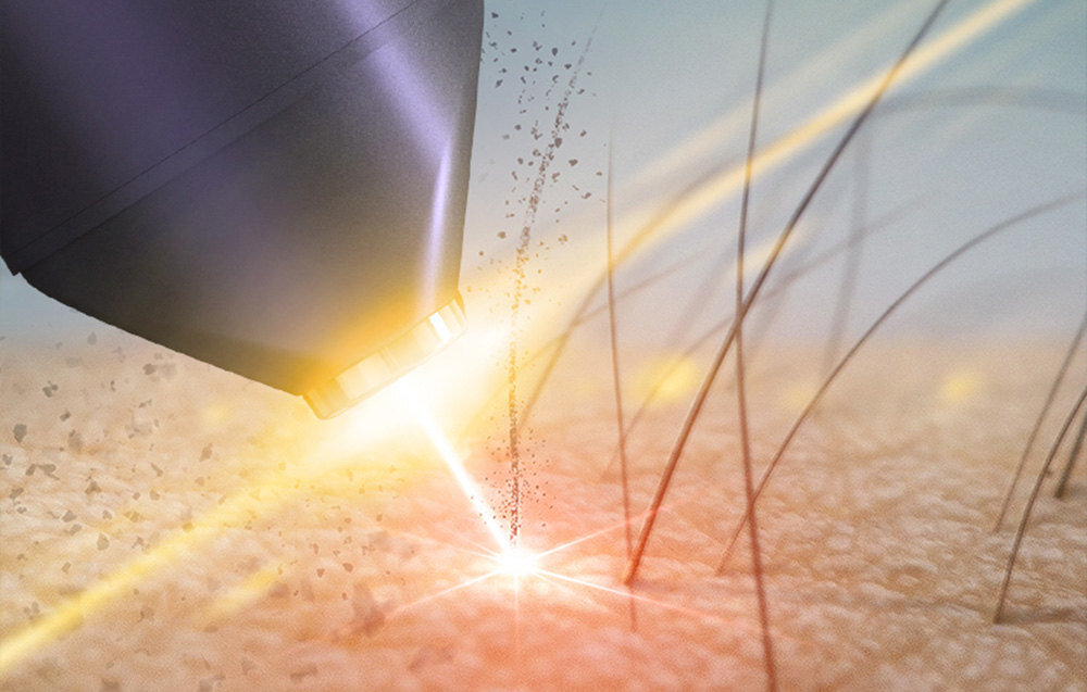 Depilator KENSEN Hammer IPL MZ-IPL01 bezbolesnie uzytkowanie funkcja chlodzenia