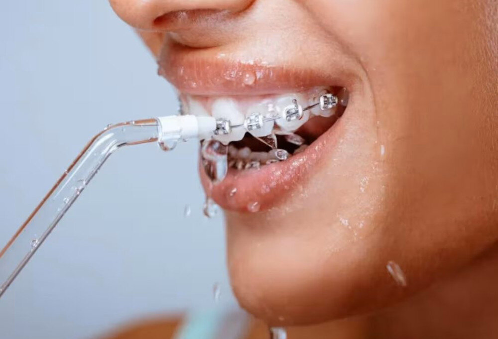 Irygator EXTRALINK Beauty Smartlife Wsparcie w ortodoncji i protetyce ułatwienie higiena korony mosty implanty precyzja czyszczenie