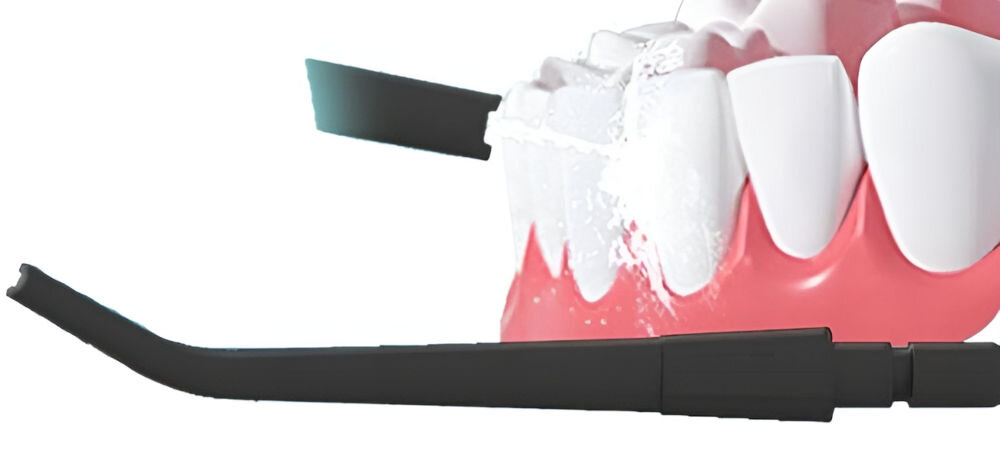 Końcówka do irygatora SHONA S200 Czarny (4 sztuki) (Dokładna higiena jamy ustnej) zestaw czterech końcówek kompleksowa pielęganacja jamy ustnej kazda dysza inny aspekt higieny standardowa dysza wszechstronne głębokie czyszczenie usuwanie płytki nazębnej dysza ortodontyczna aparaty ortodontyczne usuwanie płytki i resztek jedzenia  