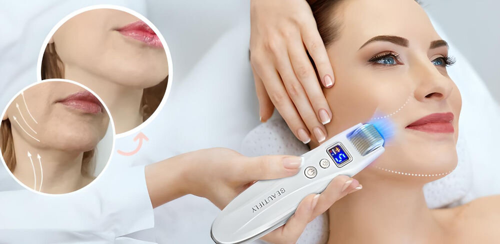 Urządzenie do mezoterapii BEAUTIFLY MicroGlow PRO microneedling dwa rodzaje światła LED czerwone poprawa elastyczności przywrócenie witalności skóry niebieskie eliminacja trądziku działanie antybakteryjne rewitalizacja skóry twarzy szyi i dekoltu normalizowanie kolorytu skóry ochrona przed wolnymi rodnikami