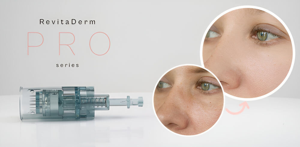 Urządzenie do mezoterapii BEAUTIFLY RevitaDerm PRO intensywny zabieg skuteczne niwelowanie intensywności skóry technologia mikroigłowa przenikanie substancji w głąb tkanek twarz szyja dekolt 