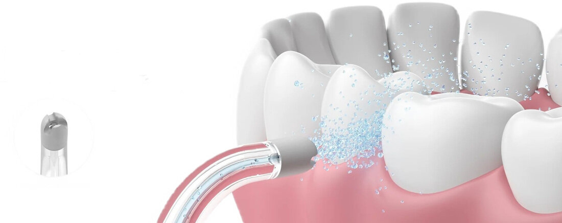 Oryginalna końcówka do irygatora OCLEAN A10 Przezroczysty (Dokładna higiena jamy ustnej)  oczyszczanie jamy ustnej pod optymalnym kątem skuteczne usuwanie resztek jedzenia, bakterii oraz osadu zdrowe dziąsła i świeży oddech