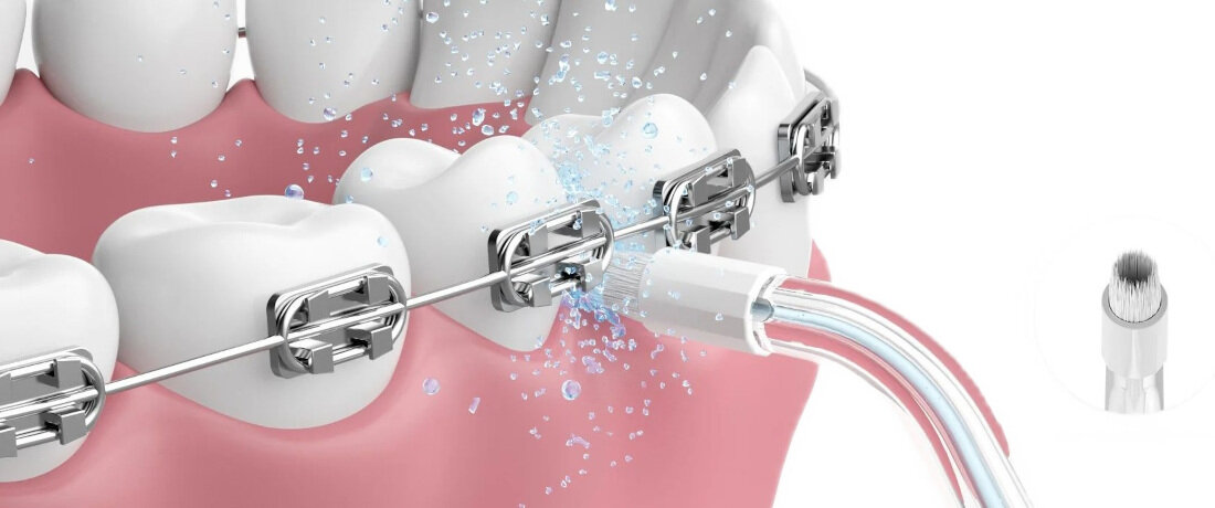 Oryginalna końcówka do irygatora OCLEAN A10 Przezroczysty (Dokładna higiena jamy ustnej)  wygoda użytkowania wykonanie z wysokiej jakości materiałów Zalecany czas użytkowania korzystanie