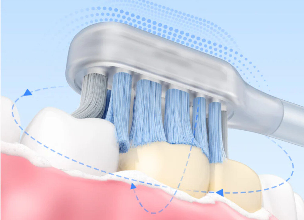 Szczoteczka soniczna DREAME Mova Fresh Pro Czarny Dynamiczne ruchy soniczne sprzyja ochronie przed próchnicą Trudno dostępne miejsca