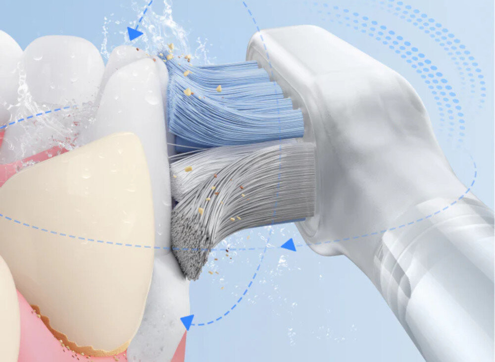 Szczoteczka soniczna DREAME Mova Fresh Pro Czarny Włosie w kształcie diamentu  przebarwienia ultracienkie końcówki 0,01 mm Włókna wspierające dokładność