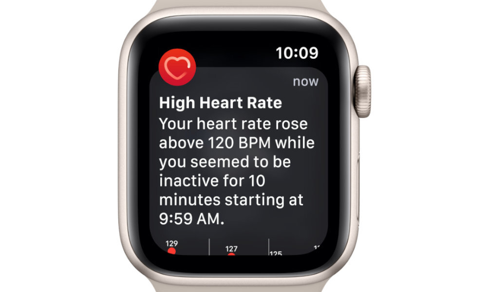 APPLE Watch SE Zdrowie serca pod ścisłą obserwacją