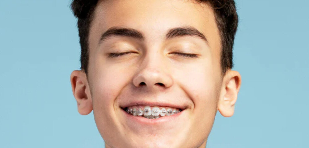 Oryginalna końcówka szczoteczki ORDO Sonic Kids Squishmallows Biały (4 szt.)  Wygodne stosowanie z aparatami wokół zamków, gumek i drutów ułatwienie czyszczenie