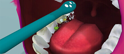 Ilustracja przedstawia szczoteczkę soniczną w pobliżu otwartych ust z widocznymi zębami i językiem. Wokół szczoteczki znajdują się animowane postacie i bąbelki.