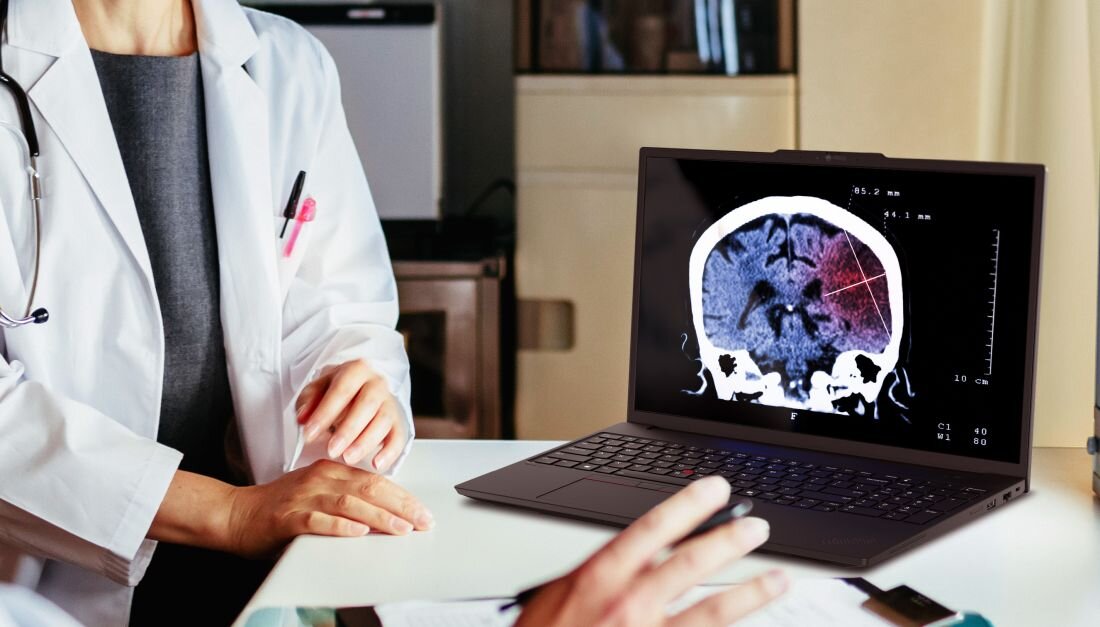Kobieta lekarz analizuje tomografię mózgu na laptopie Lenovo ThinkPad podczas konsultacji medycznej w gabinecie. - Intel Core Ultra NVIDIA RTX 