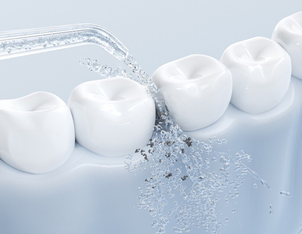 Irygator JIMOK S5 Żółty Trudno dostępne miejsca osady z ciasnych przestrzeni spod linii dziąseł zdrowe dziąsła świeży oddech