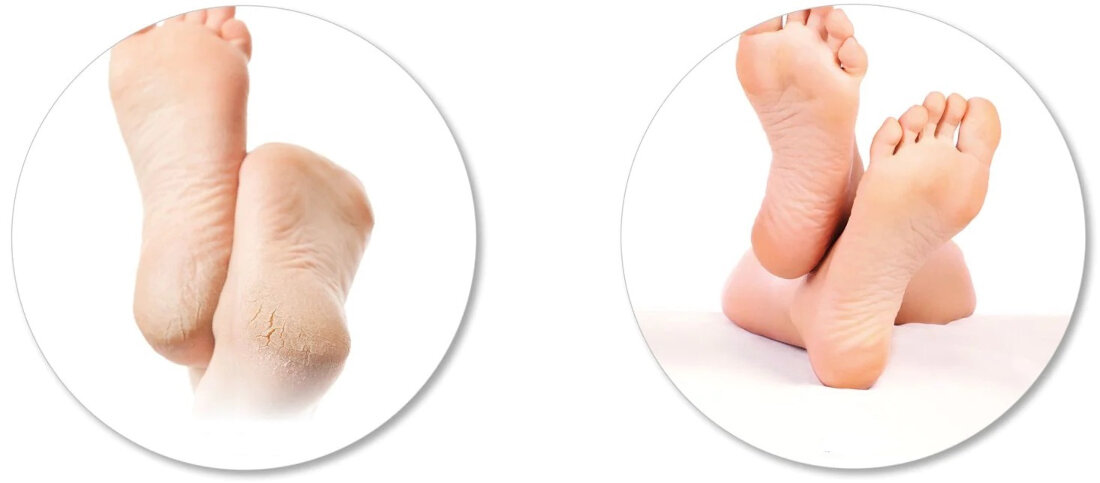 Pilnik elektryczny do stóp RIO 60 Second Pedi Hard Skin Remover skutecznie szybko efekty rezultaty