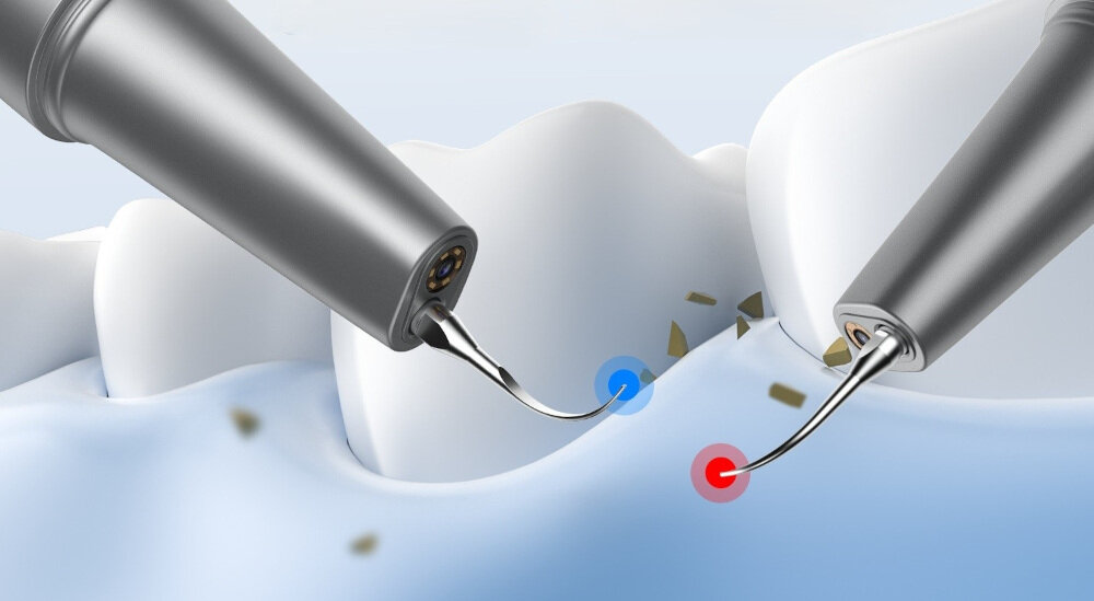 Skaler do zębów EXTRALINK Ultradźwiękowy CS-02 Precyzyjne usuwanie osadów usuwać kamień nazębny, płytkę bakteryjną i uporczywe przebarwienia wspierając zdrowie dziąseł i zębów