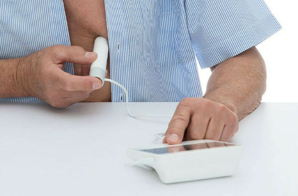 Ciśnieniomierz BEURER BM95 funkcja wykrywania arytmii aplikacja Beurer CardioExpert bezpłatnie sprawdzać wskaźnik ryzyka wynik nie jest zbyt wysoki