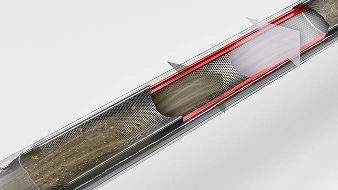 Zbliżenie na przekrój podłużnego pojemnika zawierającego zanieczyszczenia