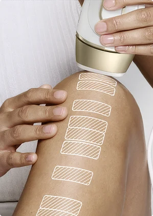 Urządzenie do depilacji używane na nodze z poprzednią głowicą, pokazujące niepełne pokrycie skóry.