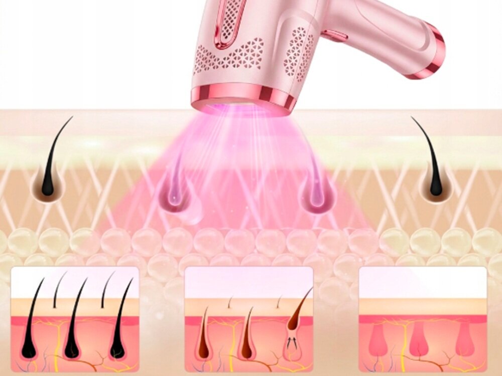 Depilator FITBYMED BHRL4-RS IPL Ice Cool 9 poziomów intensywnosci, dopasowany zabieg, czytelny panel dotykowy