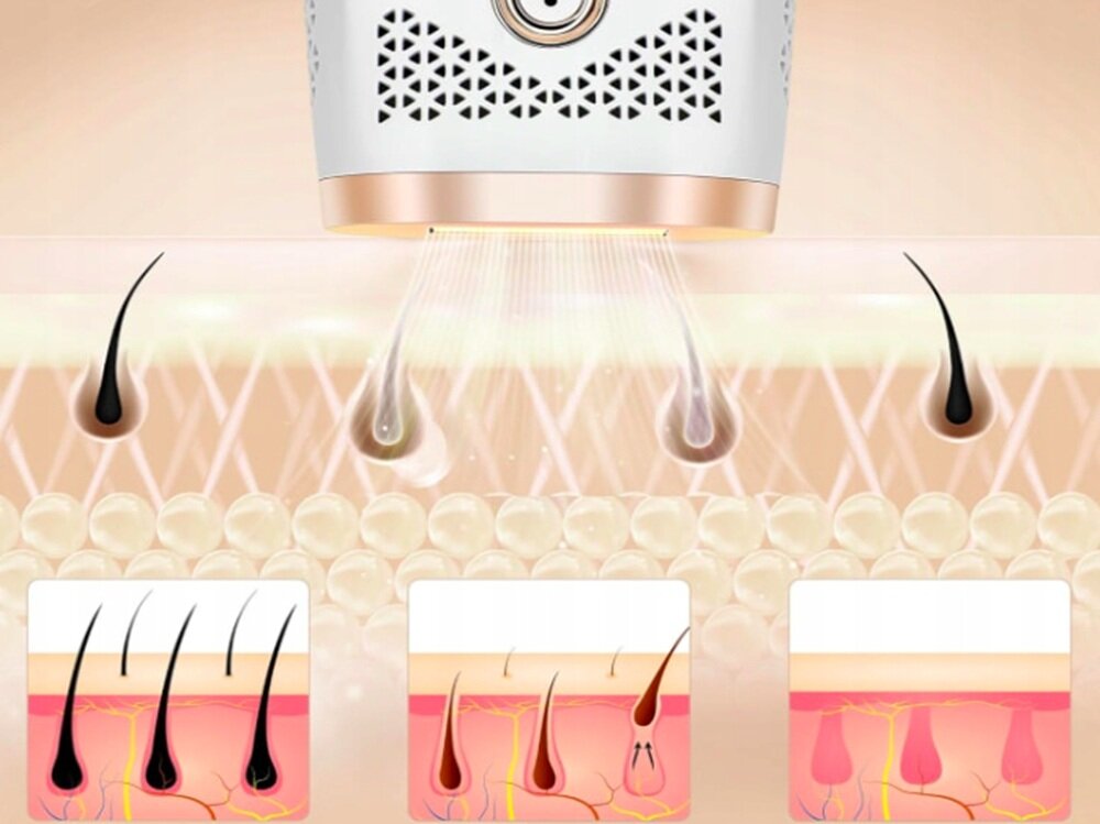 Depilator FITBYMED BHRL4-WH IPL Ice Cool 9 poziomów intensywnosci, dopasowany zabieg, czytelny panel dotykowy