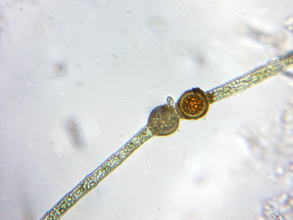 Mikroskop DELTA OPTICAL Biolight 100 Zestaw 