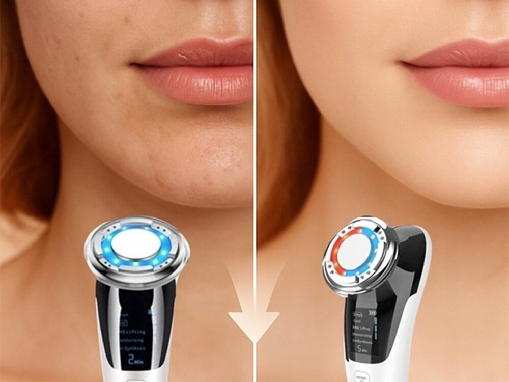 Urządzenie do mezoterapii bezigłowej FITBYMED FBM59106 5 trybów pracy, oszczyszczanie, lifting ems, krioterapia, nawilżanie, wsparcie kolagenu