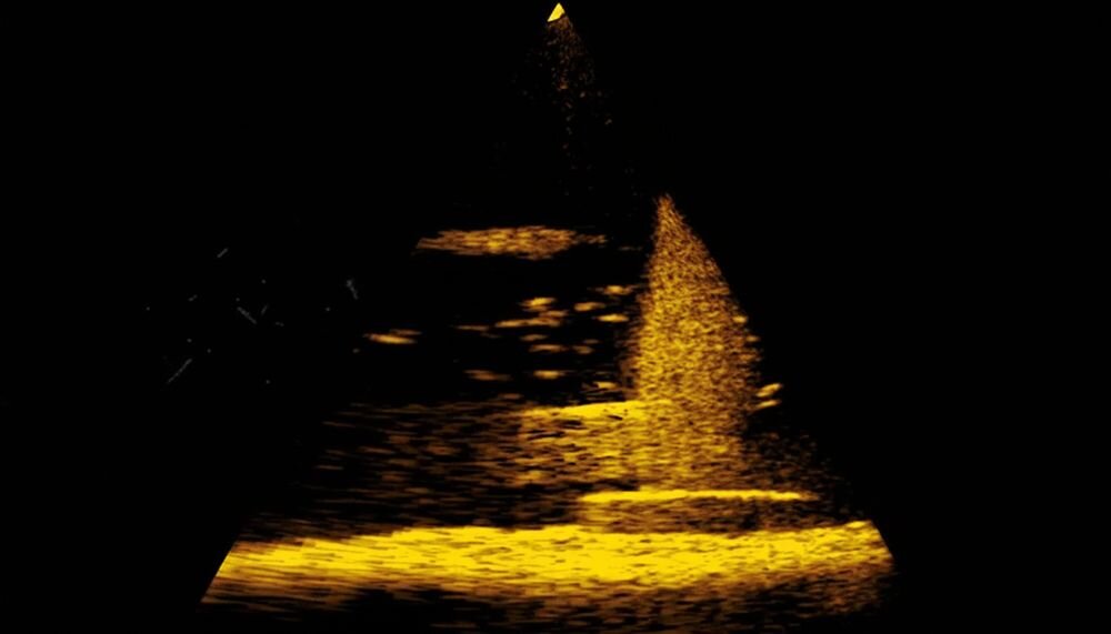 LOWRANCE Eagle Eye 9 Live echosonda wędkarska widok w dół głębokość ryby pod łodzią, kadr z urzadzenia