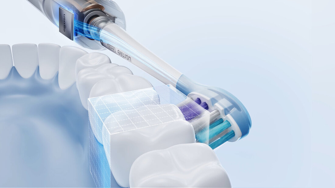 Szczoteczka soniczna USMILE Y10 Czarny Mikropęcherzyki w działaniu Dynamiczne wibracje tworzą mikropęcherzyki dokładna higiena jamy ustnej 