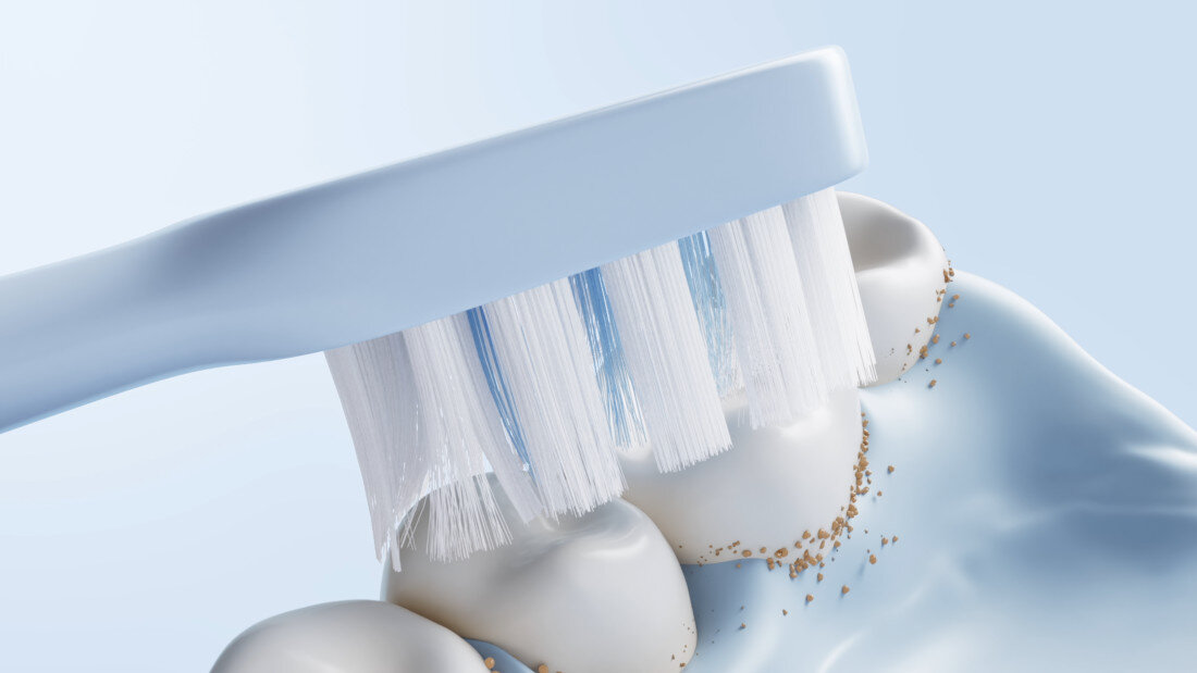 Oryginalna końcówka szczoteczki USMILE Advanced Sensitive (2 szt.) (Dokładna higiena jamy ustnej) Stworzona dla wrażliwych dla osób z wrażliwymi dziąsłami, dzieci, seniorów oraz użytkowników po zabiegach stomatologicznych codzienna higiena jamy ustnej