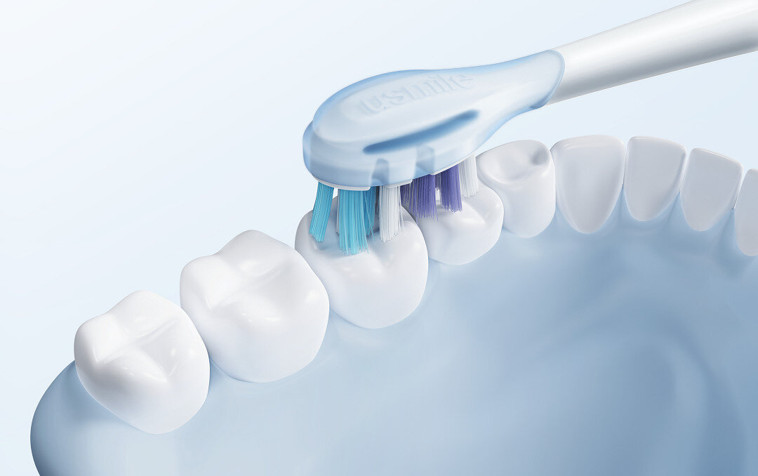 Oryginalna końcówka szczoteczki USMILE Advanced Sensitive (2 szt.) (Dokładna higiena jamy ustnej) Ochrona przed naciskiem Wbudowana poduszka powietrzna amortyzuje nacisk delikatność czyszczenia