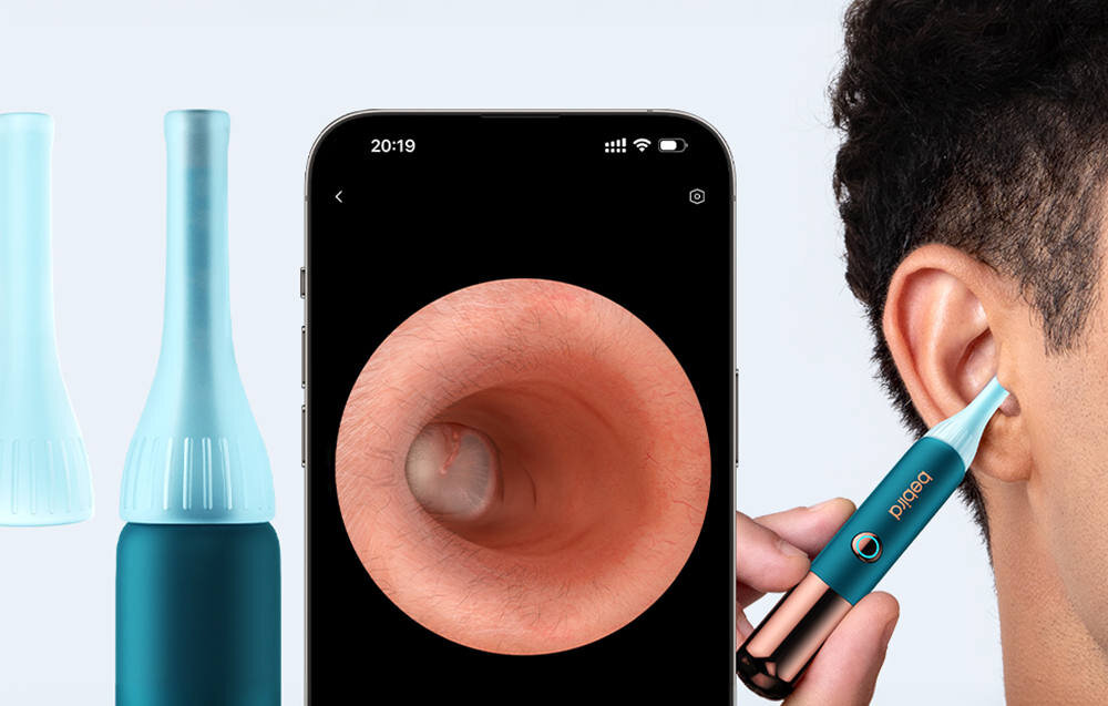 Otoskop z kamerą BEBIRD Earsight Ultra Niebieski Wsparcie analizy obrazu Funkcja Ear Canal Assessment aktualizacja OTA czyszczenie podgląd na telefonie