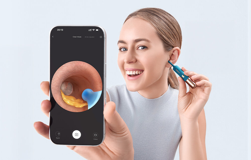 Otoskop z kamerą BEBIRD Earsight Ultra Niebieski Obraz pod pełną kontrolą Kamera 20 MP z transmisją 5G podgląd obrazu w czasie rzeczywistym ogniskowa 7 mm zakres ostrości 5–25 mm Szeroki kąt 77° zdjęcie lifestyle osoba uzytkuje w ucho i pokazuje telefon z podglądem