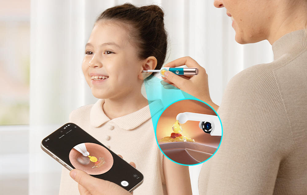 Otoskop z kamerą BEBIRD Earsight Ultra Niebieski Stała obserwacja stanu Możliwość podglądu obrazu na smartfonie praktyczne wsparcie w codziennej profilaktyce kontrola stan zdrowia podgląd na żywo zdjęcie lifestyle