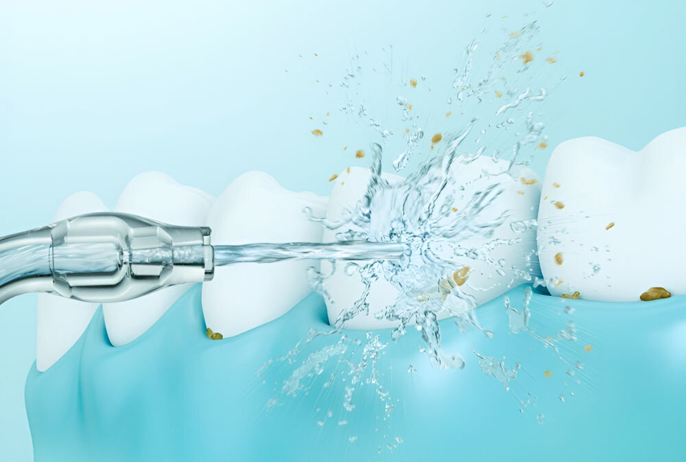 Obraz przedstawia irygator dentystyczny kierujący strumień wody na zęby, usuwając resztki jedzenia. Tło jest jasnoniebieskie, a zęby są białe.