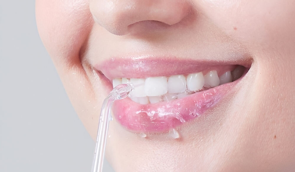 Zbliżenie na usta osoby używającej irygatora do czyszczenia zębów. Widać przezroczystą końcówkę urządzenia skierowaną na zęby.